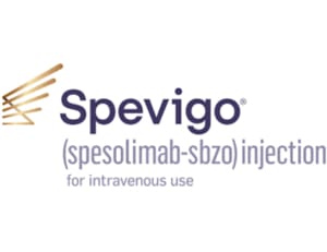 Spevigo